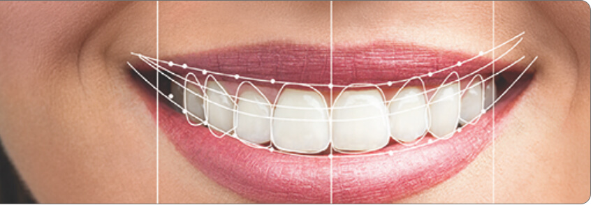 digital smile design